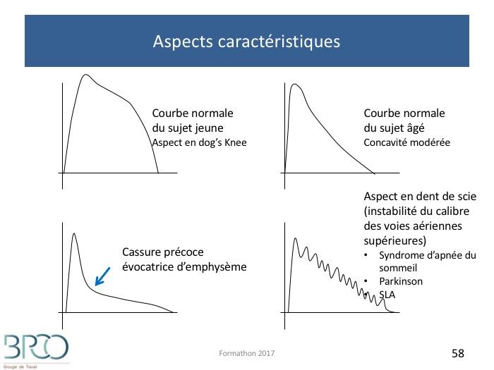 Sommeil et valeurs normales : utilité pour le praticien